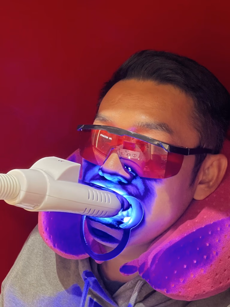 台中牙齒美白推薦 Attraction Dr.4