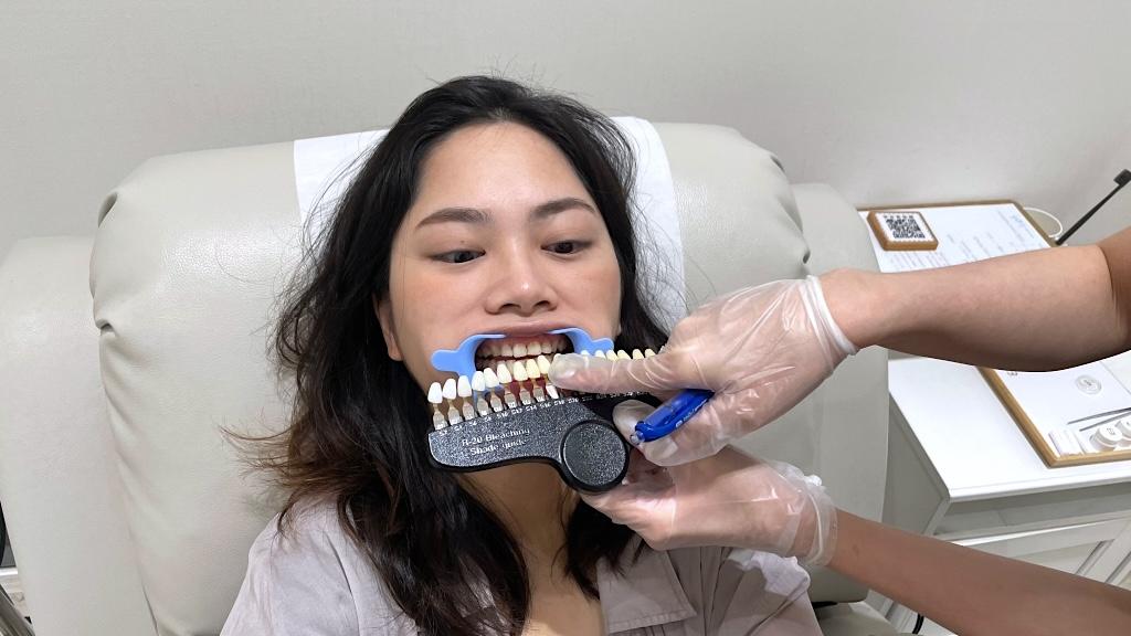 台中牙齒美白推薦 2024 BRIGHTEETH2